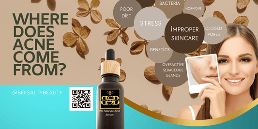 Unmasking Acne: Surprising Causes and How Bee Salty's AcneClear Serum Can Help
