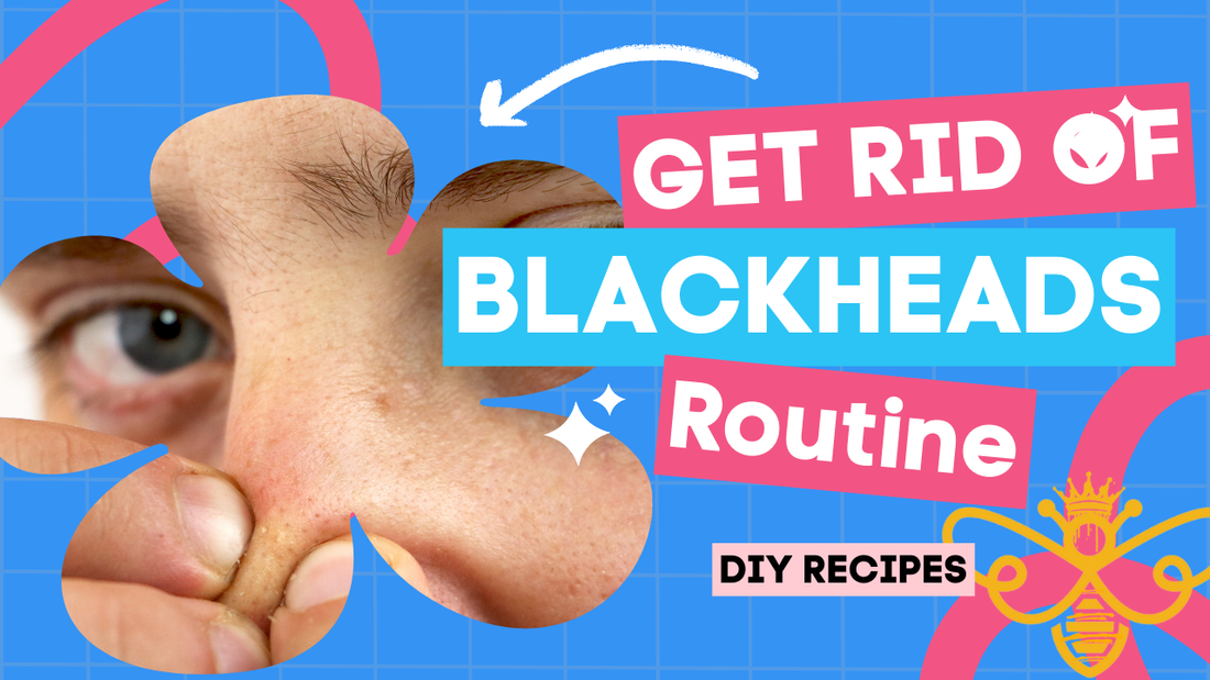 Natural Ways to Tackle Blackheads: DIY Skincare Tips from Bee Salty